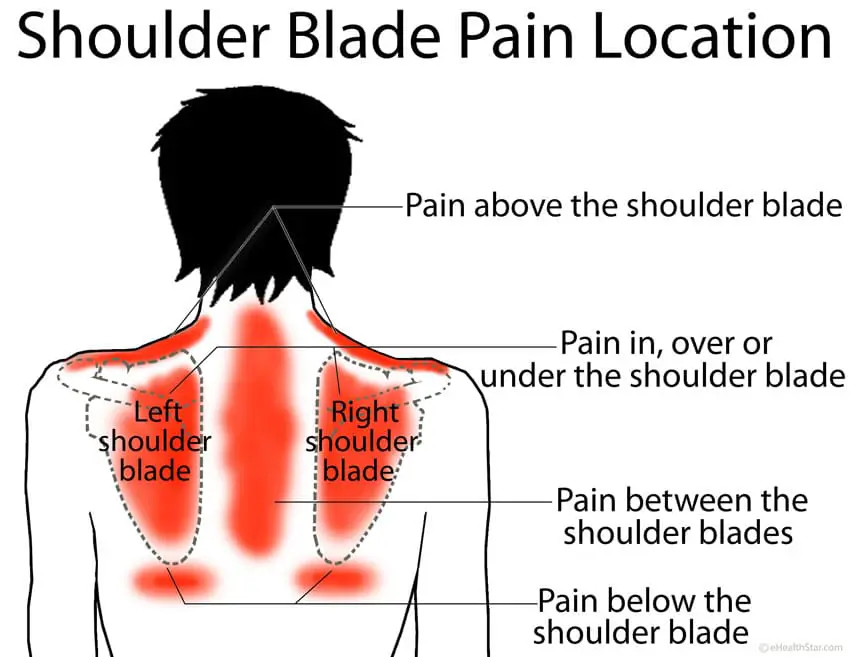 Боль под левую лопатку спины причины лечение. Болит область лопаток. Боль в спине в области лопаток. Болит под лопаткой. Болит спина со стороны лопаток.