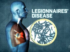 Legionnaires’ Disease