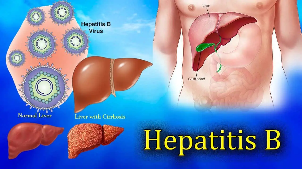 Вирусные гепатиты. Гепатит б 2024