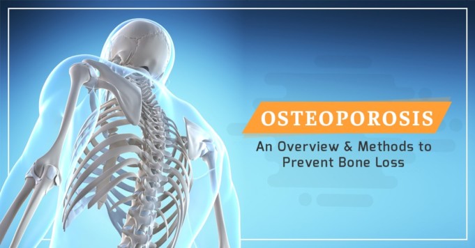 Osteoporosis : An Overview & Methods to Prevent Bone Loss