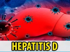Hepatitis D