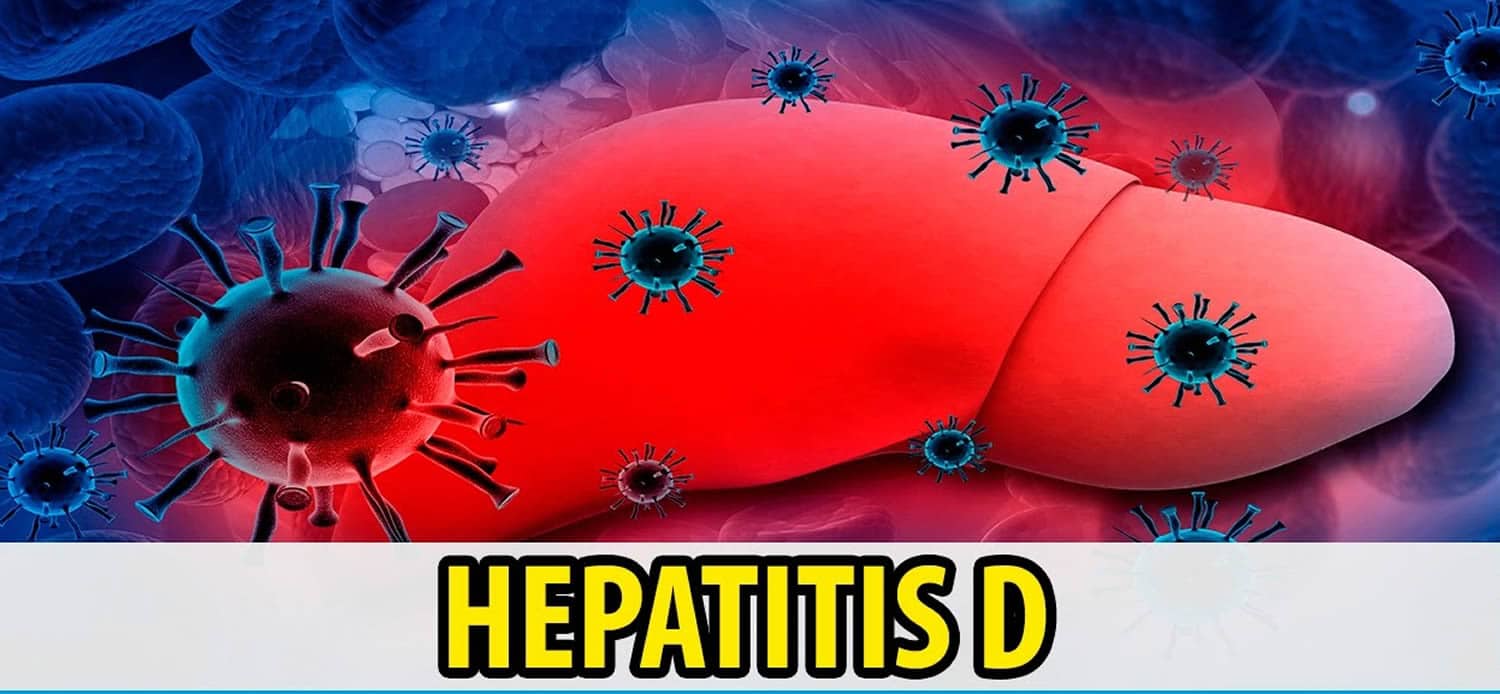 hepatitis d presentation