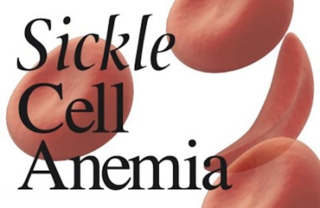 Sickle Cell Anemia – Types, Causes, Symptoms and Treatment | Healthtian