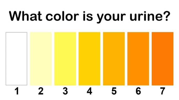 Urine Colour