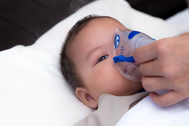 Respiratory Syncytial Virus (RSV): Causes, Symptom and Treatment