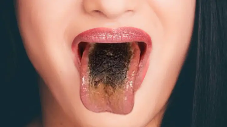 tongue with hair