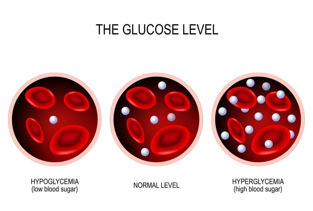 Difference Between Hypoglycemia And Hyperglycemia Healthtian