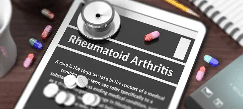 What to Expect When Switching to Biologic Drugs for RA Treatment ...