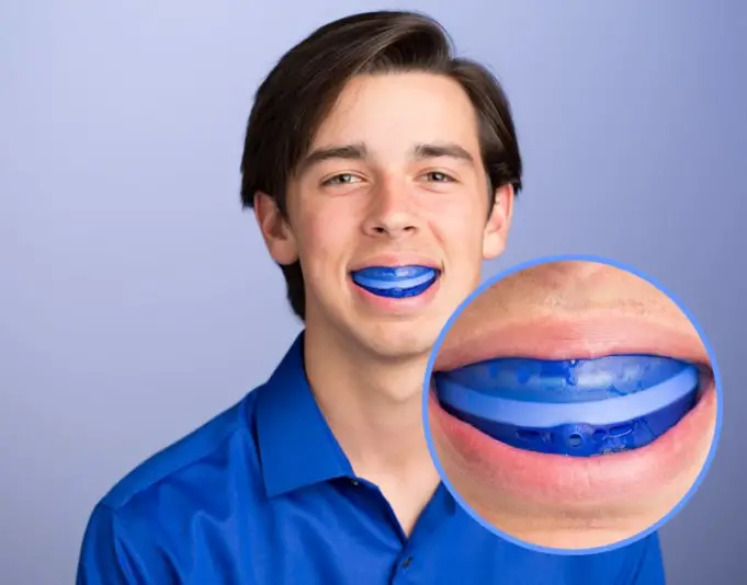 Mouthguards – Everything You Need to Know | Healthtian