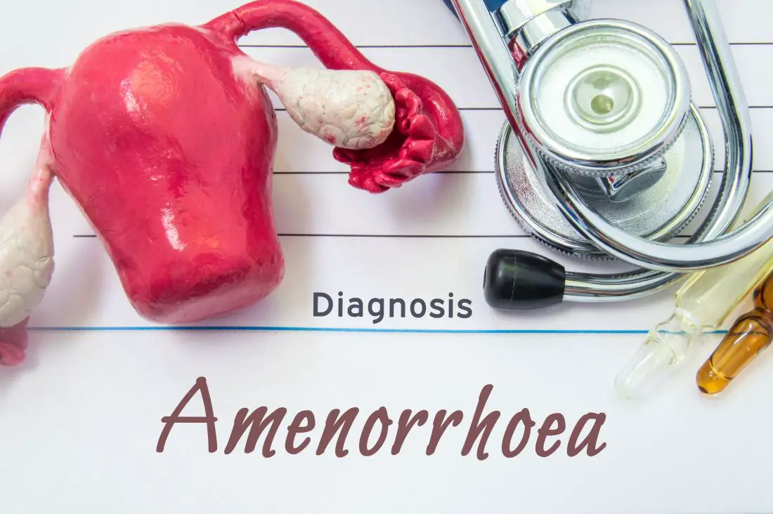 Amenorrhea – Types, Causes, Symptoms And Treatment | Healthtian