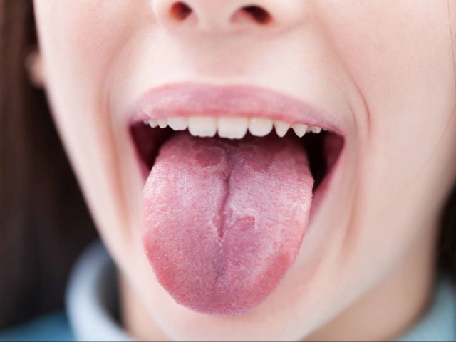 oral-sweetness-it-s-causes-and-symptoms