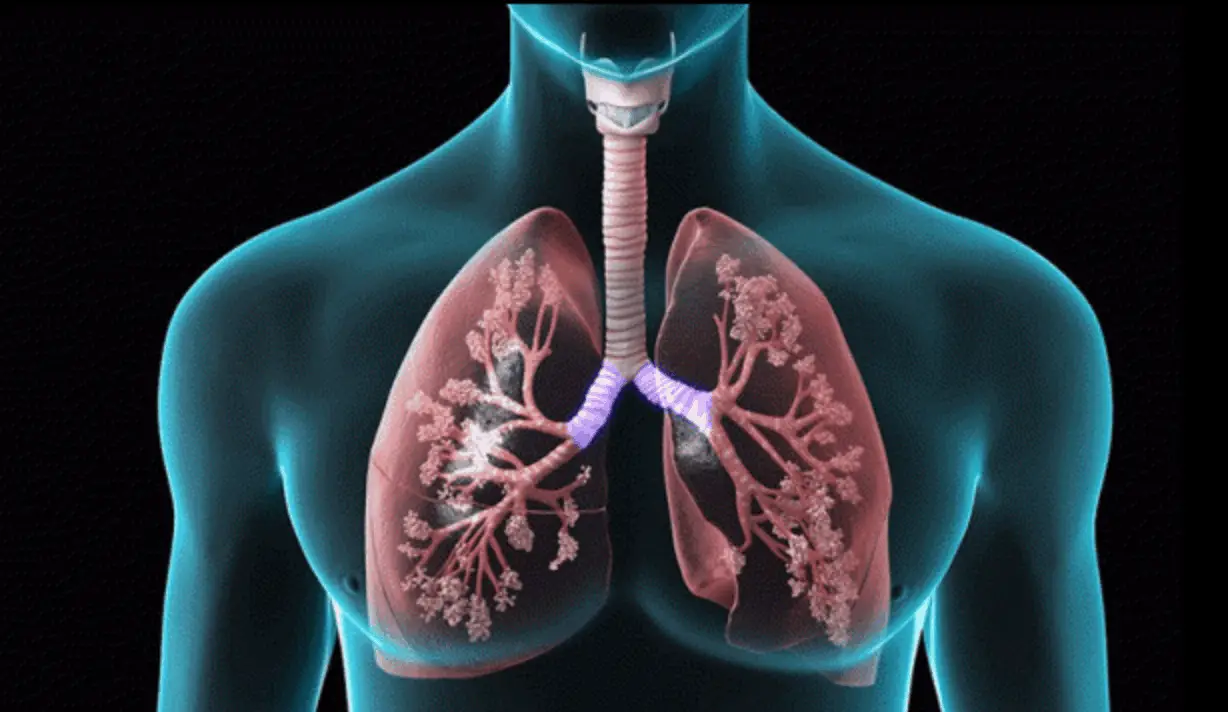 Home Remedies For Chronic Obstructive Pulmonary Disease COPD 