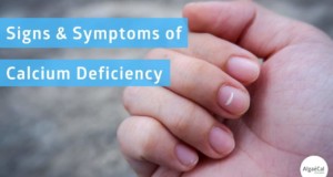 Calcium Deficiency Hypocalcemia