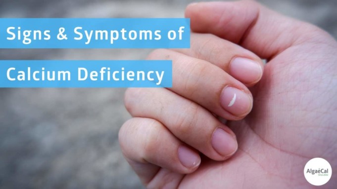 Calcium Deficiency Hypocalcemia
