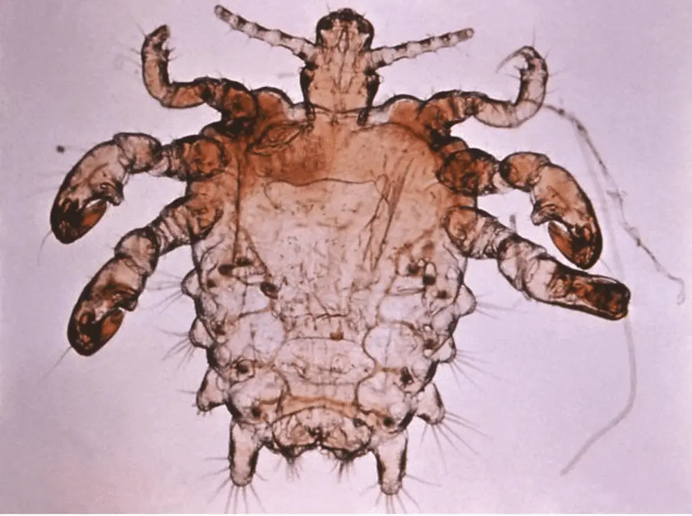 Pubic Lice Crabs Std Symptoms Treatment Causes