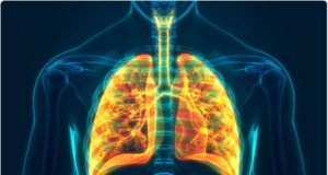 COVID-19 And COPD