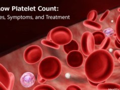 Low Platelet Count Thrombocytopenia