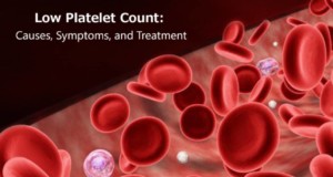 Low Platelet Count Thrombocytopenia