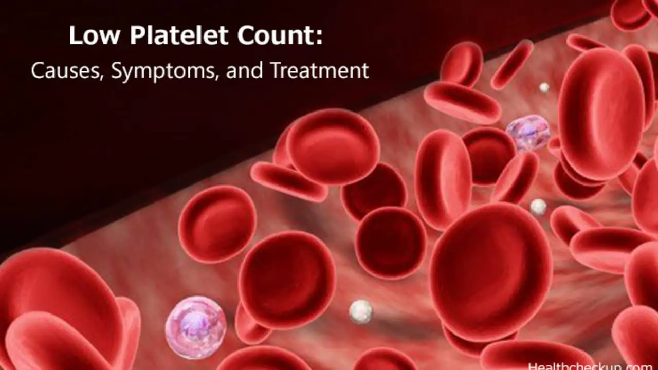 low-platelet-count-thrombocytopenia-causes-and-symptoms-healthtian