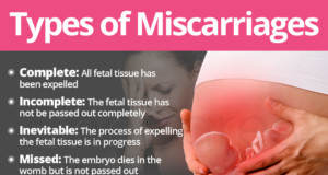 Types of Miscarriages