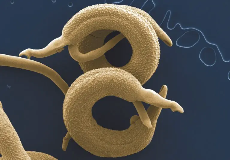 Helminths Parasitic Worm And How They Affect You Healthtian 2747