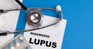 Lupus and COVID-19