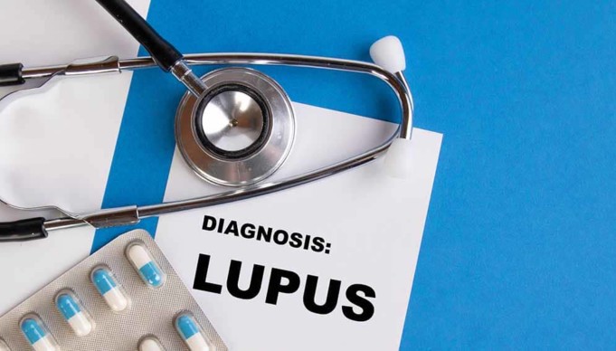 Lupus and COVID-19