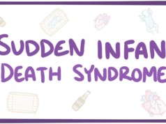 Sudden Infant Death Syndrome
