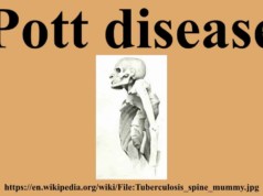 Pott Disease