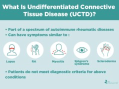 Undifferentiated Connective Tissue Disease