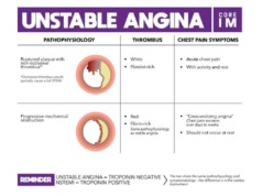 Unstable Angina