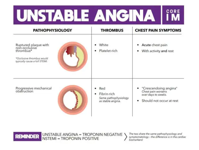 the clinical presentation of unstable angina