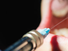 anesthesia for dentistry