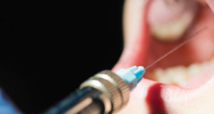 anesthesia for dentistry