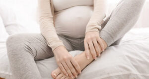 Managing Pregnancy Swelling
