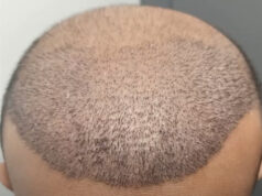 Close-up of a short buzz-cut hairstyle